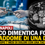 Sala operatoria e Tac con forbici chirurgiche dimenticate nell’addome di una donna dopo un intervento a Napoli